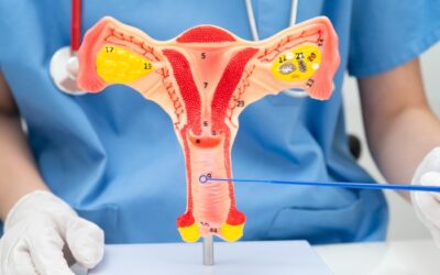 Can Fibroids Cause Weight Gain? Understanding the Connection Between Uterine Fibroids and Your Body