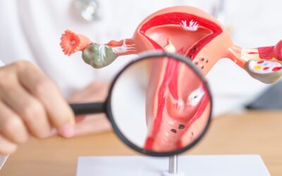 How to Shrink Fibroids Naturally: Safe, Evidence-Based Ways to Support Uterine Health