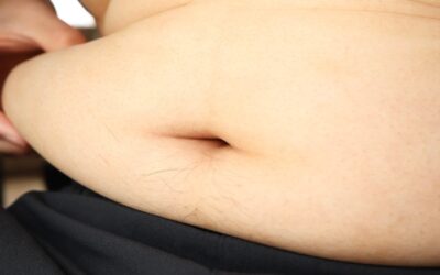 Fibroid Belly: Why Your Stomach Looks Pregnant and What You Can Do About It